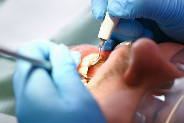 Best Cracked Tooth Emergency Dentist  in Hutchinson, MN
